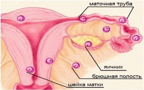 Беременность расхождение лонного Беременность расхождение лонного