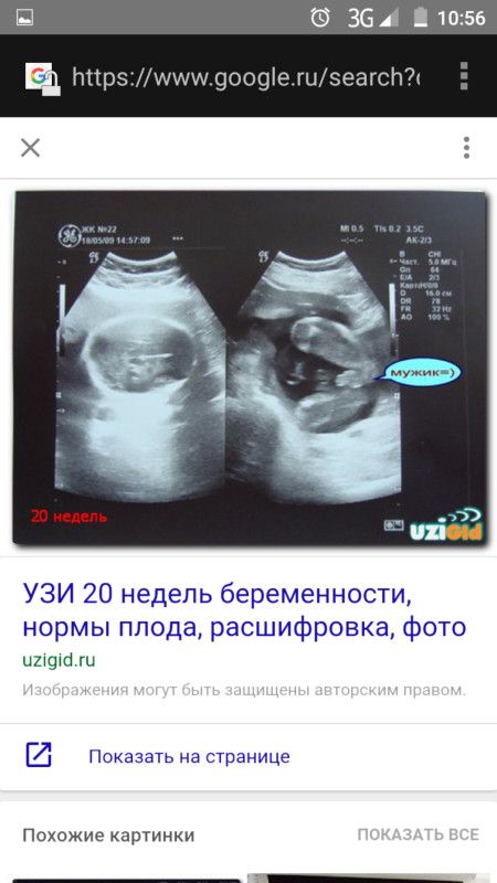 Может ли узи ошибаться с количеством плодов Может ли узи ошибаться с количеством плодов