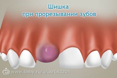 Родинка на губе: значение у женщин слева и справа Пятница, картинки, открытки, анимация