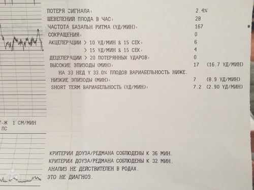 Беременность ктг и псп