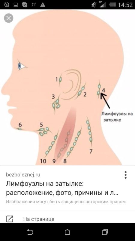 Воспалились лимфоузлы на шее как лечить дома Воспалились лимфоузлы на шее как лечить дома