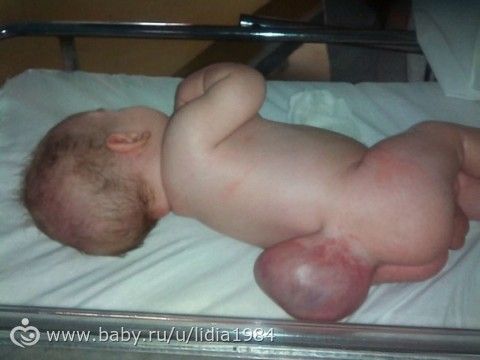 Как восстановить коленные суставы народными средствами Как восстановить коленные суставы народными средствами