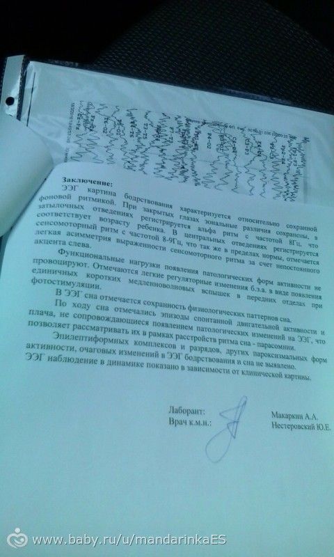 Как сделать ээг в семашко Как сделать ээг в семашко