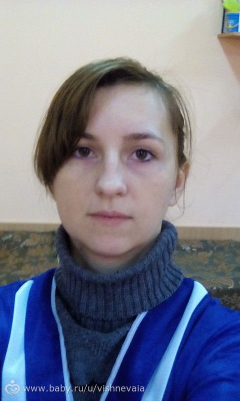 Удалила я девочки зуб мудрости
