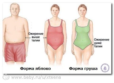 Степени ожирения по индексу массы тела (ИМТ)