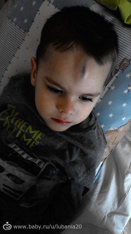 Травма в детском саду