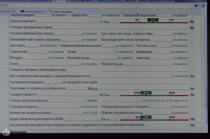 Узи 31 и 5 дней...Не выдержала)