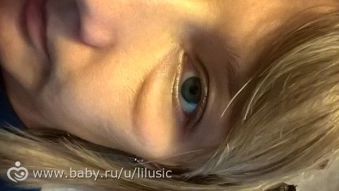 У меня отек квинке???