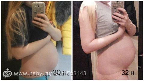 32 недели и 3 узи