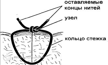 После КС