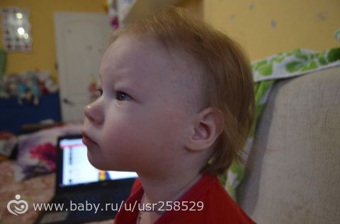 пятнышки на теле у ребенка,аллергия или нет не пойму