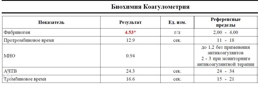 Контракт заключен!