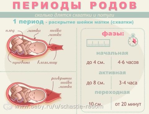 РОДЫ: ВЗГЛЯД НЕРАВНОДУШНОГО ВРАЧА