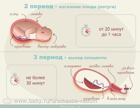 РОДЫ: ВЗГЛЯД НЕРАВНОДУШНОГО ВРАЧА