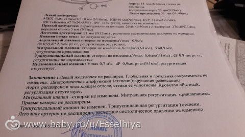 Узи сердца