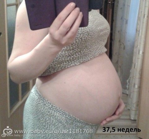 Опустился живот или мне кажется