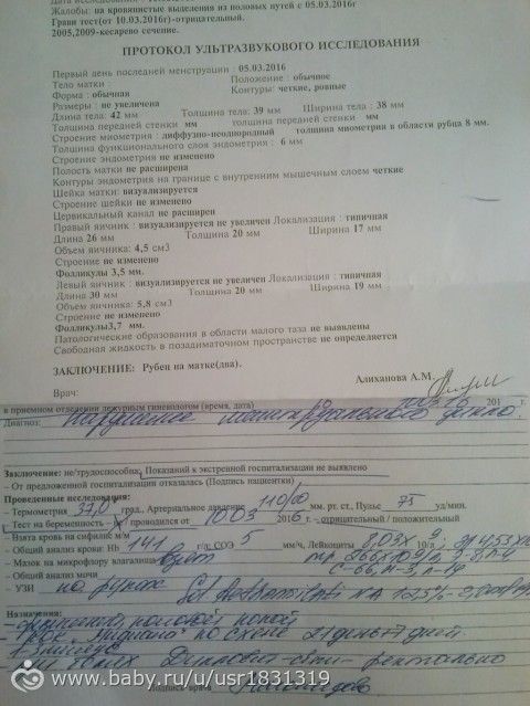 ну вот, сбой предлагают контрацептивы Мидиана