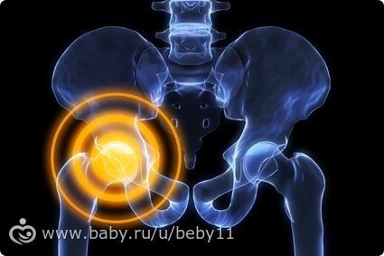 Боли в тазобедренном суставе(