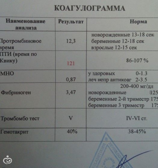 Коагулограмма