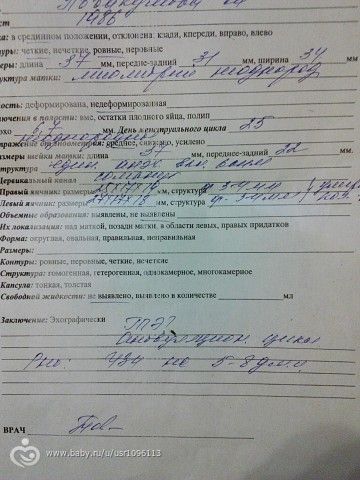 не могу разобрать узи