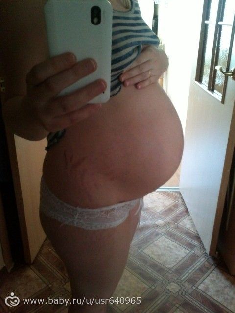 36 недель/ 9-й месяц + фото