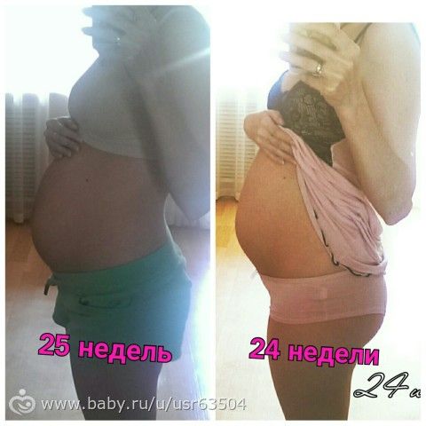 Нам сегодня 25 неделек