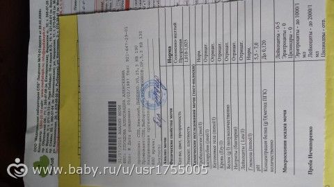 Анализ мочи